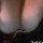 miiasis