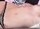 Nipple